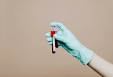 cbd detection in blood
